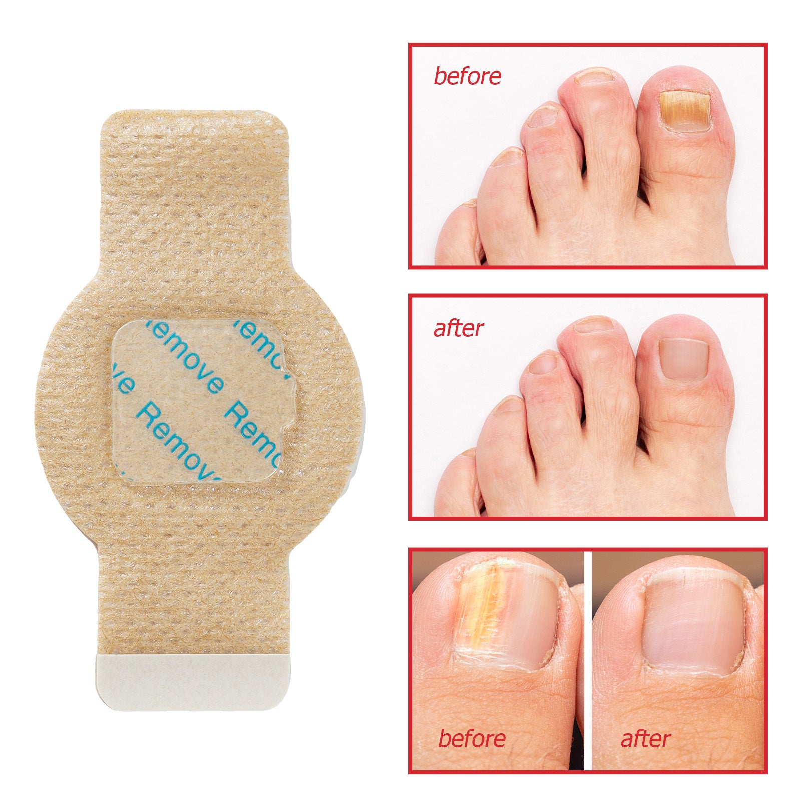 Nail Antibacterial Paste Nail Repair Correction Pull Paste Nail Groove Inflammation Nail Protection Paste